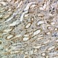 Anti-CD159a/c Antibody